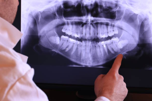 Best Emergency Treatment for Dental Infections or Abscesses in Waynesburg, PA
